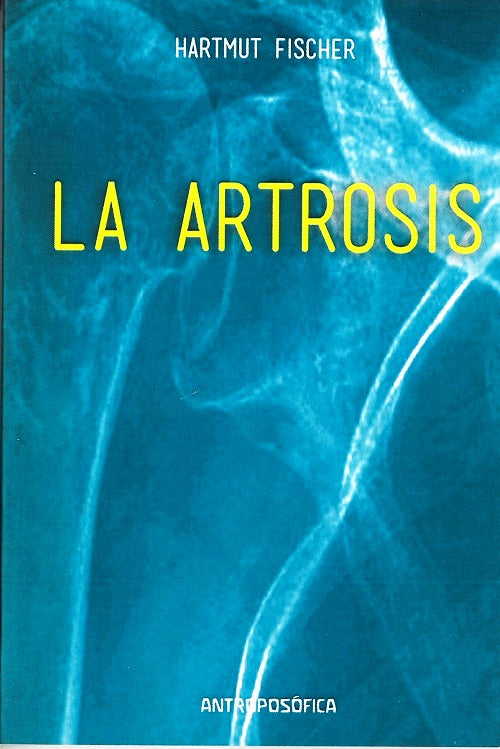 La artrosis.